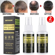 2X Topical Minoxidil 5% Spray for Hair Regrowth Treatment for Men 2 Month Supply