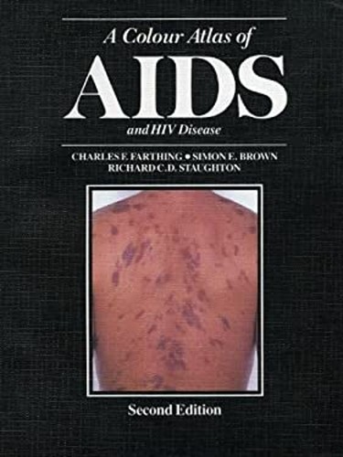 Colour atlas aids - atlas, of