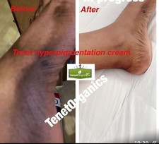 Lightening Body Cream( VERY EFFECTIVE FOR DARK FEET, DARK ELBOW, DARK ARMPIT) 
