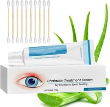 Blepharitis Treatment Eye