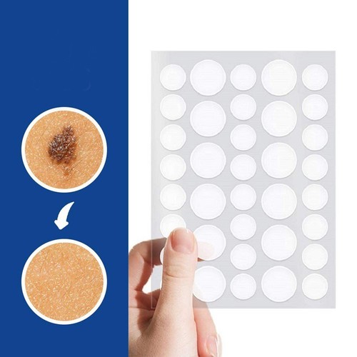 Skin tag remover - skin, patches