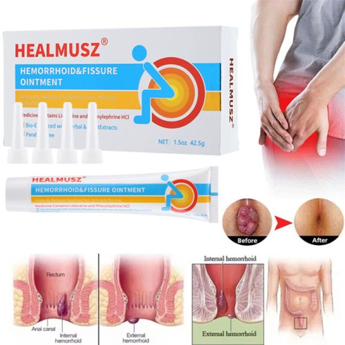 Pro hemorrhoid ointment - pro,