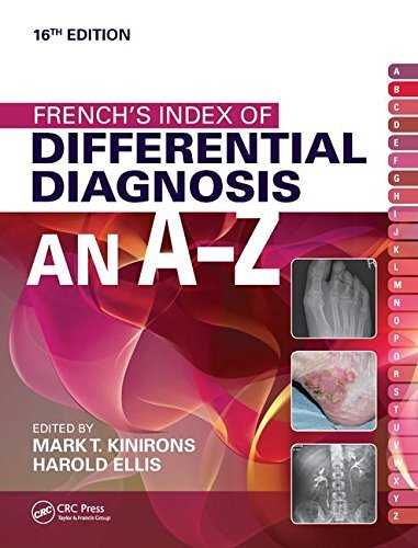 French index diff - index,