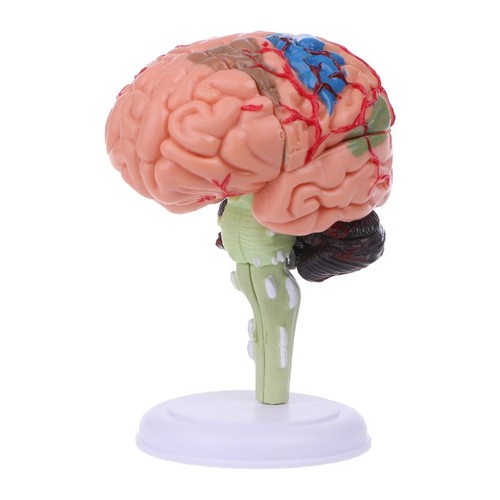 Disassembled anatomical - disassembled,
