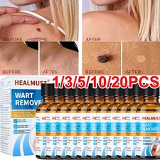 Wart Remover Liquid Skin Tag