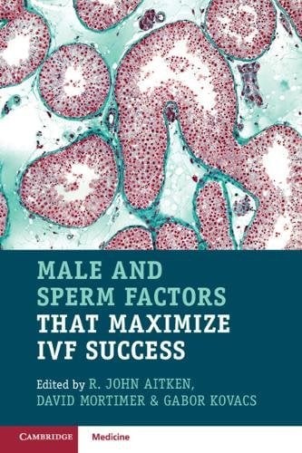 Male and sperm - sperm, factors