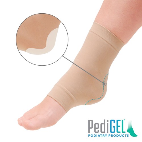 Achilles heel sleeve with - sleeve,