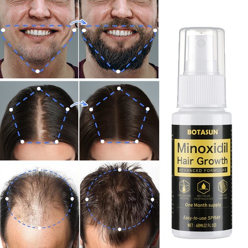 Minoxidil for men hair - men, &