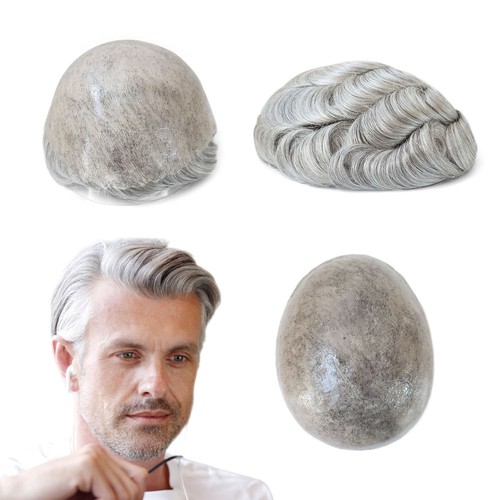 Mens toupee injection - injection, skin