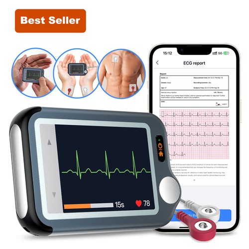 Checkme bluetooth ekg - ex,
