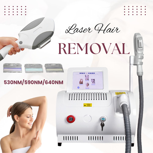 Opt ipl laser - laser, removal