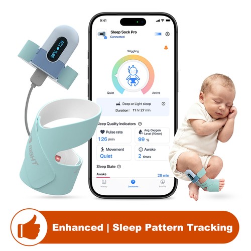 Enhanced smart sock - sock, baby