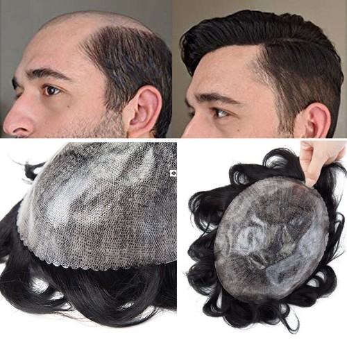 Durable hair replacement - durable,