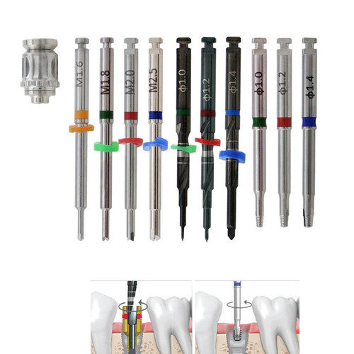 Implant fractured broken screw - implant,