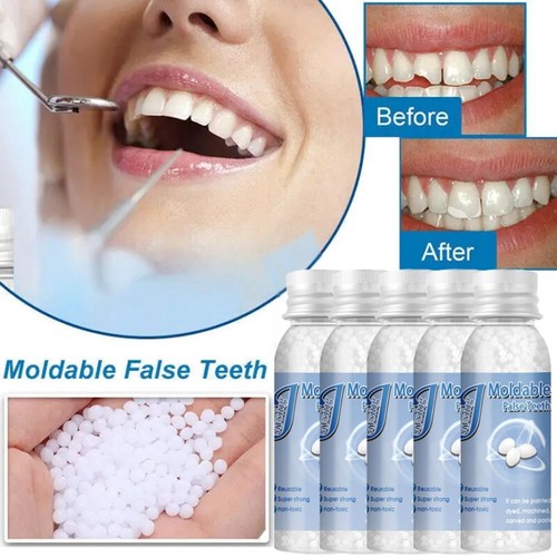 Tooth repair granules - repair,