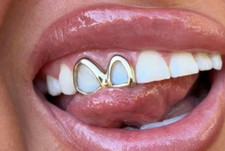 Custom Fit 14K Gold Plated