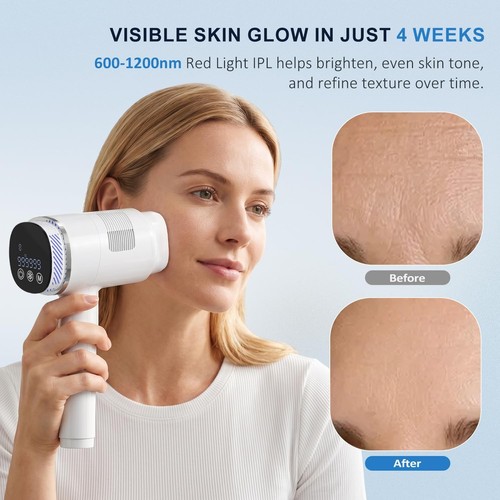 2026 ipl laser hair - ipl,