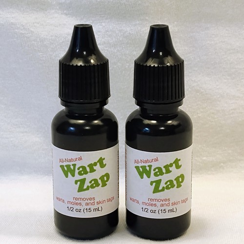 Wart zap - wart, special!!!)