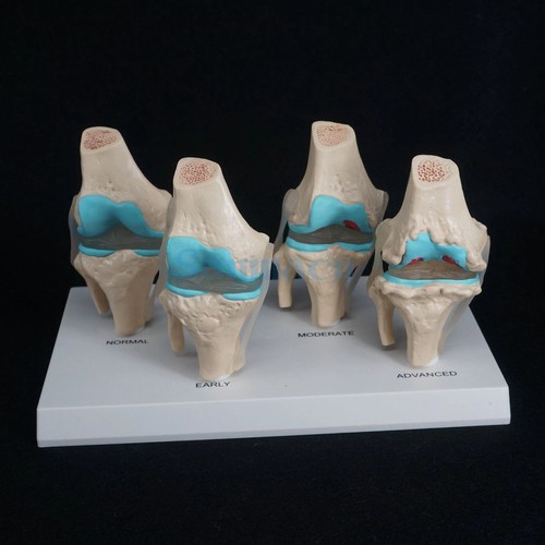Anatomical human degenerative - anatomical,