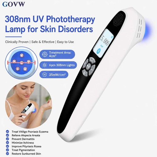 308nm uvb excimer lamp - uvb,