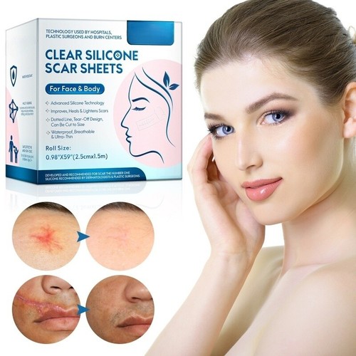 Medical silicone scar tape - medical,