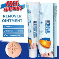 STRONG SKIN TAG REMOVER Cream NATURAL TREATMENT MOLES WARTS and TAGS