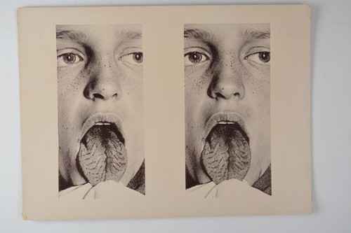 Stereoscopic medical atlas - stereoscopic,