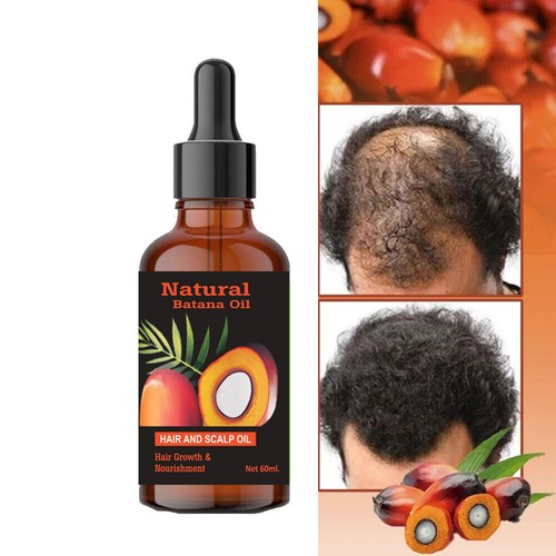 Batana oil for hair growth - for,