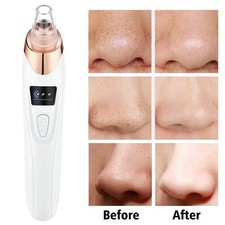 Electric Facial Skin Care Pore