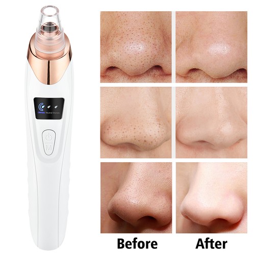 Electric facial skin care - electric,