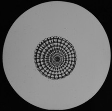 TRANS SECTION OF ECHINUS SPINE