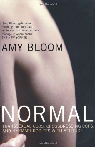Normal transs ual - transs**ual, ceos