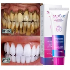 Purple Whitening Toothpaste