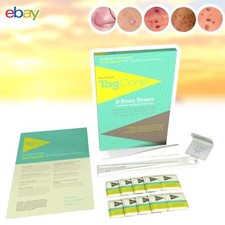 Skin Tag  Removal Kit Permanent Treatment Easy Remover Tagcone refill pack PLUS