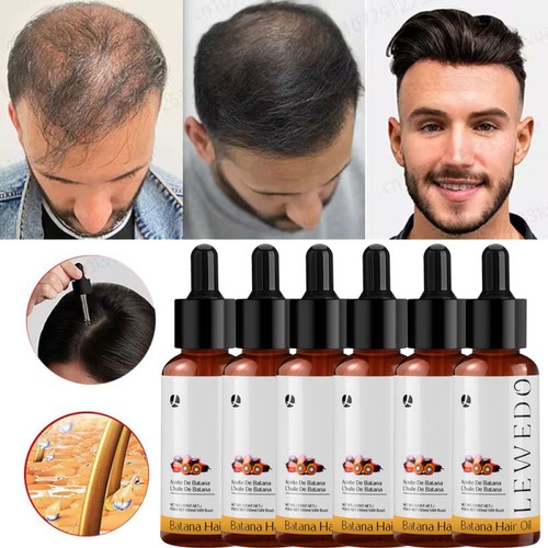 6pcs batana oil serum for - oil,