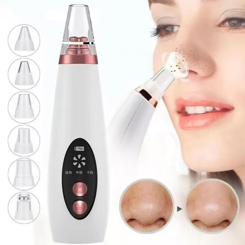 Electric blackhead remover - electric,