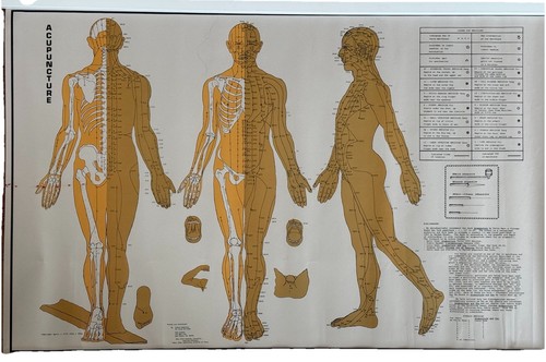 Rare vintage acupuncture - vintage,
