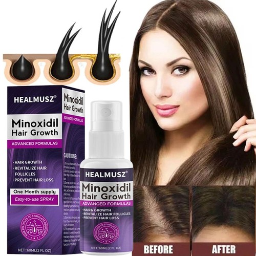 Minoxidil for women hair - 2%,