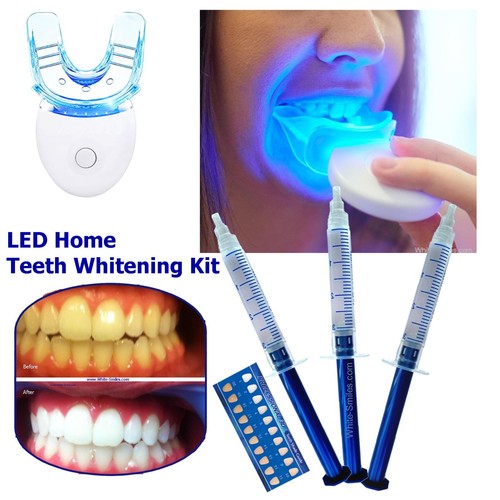 Teeth whitening kit gel - whitening, led
