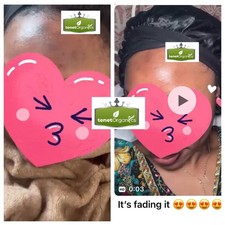 Whitening Face And Neck CREAM