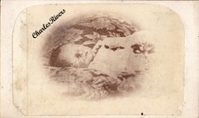 POST MORTEM CDV DECEASED CHILD