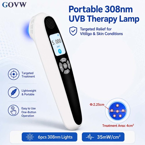 308nm uvb phototherapy device - uvb,