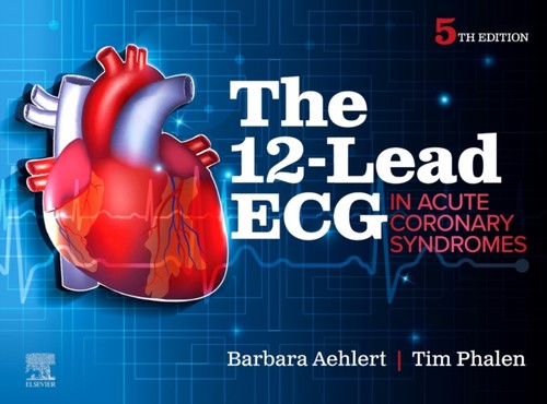 12lead ecg acute - 12lead, in