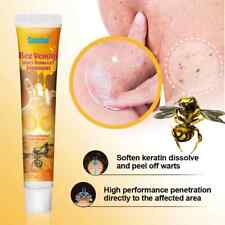 New Bee Venom Warts Remover 20g Ointment Skin Tag Treatment Remove Wart Cream