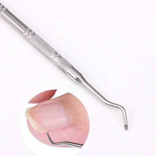 Professional ingrown toenail - ingrown,