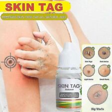Tag-Cure Skin Tag Remover | Natural & Effective | UK Premium Quality | Pain Free