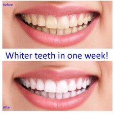 VERY STRONG  TEETH WHITENING GEL NO 36. BLEACH FOR  PROFESSIONAL USE  LARGE 10ml