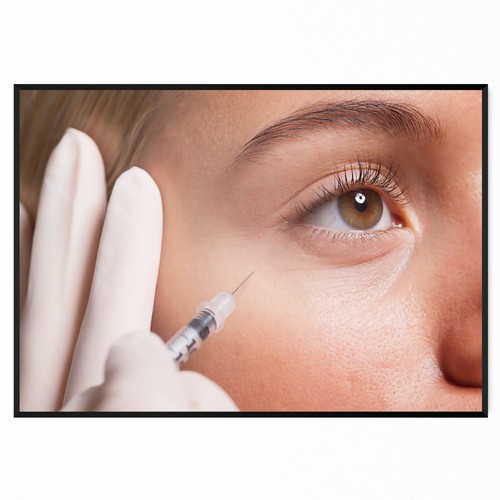 Botox dermal filler injections - dermal,