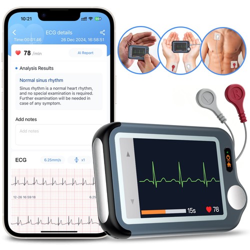 Checkmeex ecg monitor - ecg, heart