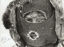 Sir Ranulph Fiennes Hand